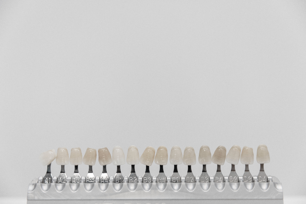 Veneers and Laminates
